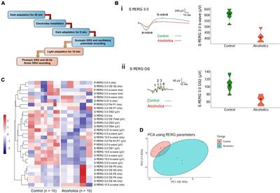 Comprehensive visual electrophysiological measurements discover crucial changes caused by alcohol addiction in humans: Clinical values in early prevention of alcoholic vision decline